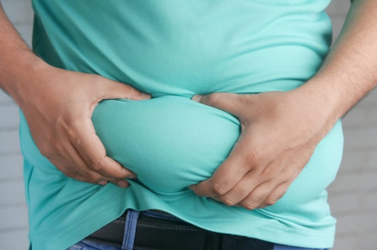 The Obesity Epidemic