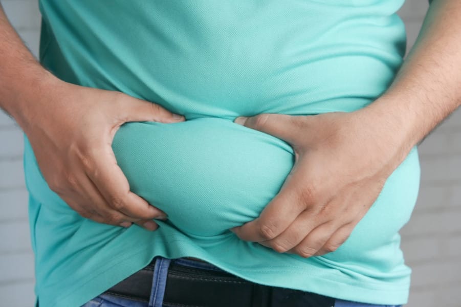 The Obesity Epidemic
